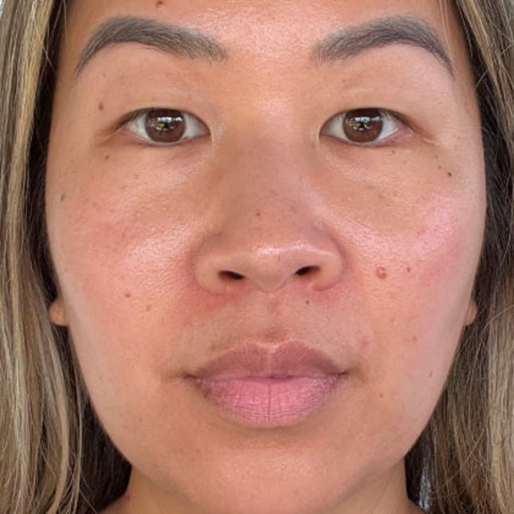 4-in-1 Radiant Renewal Skincare Wand with Red Light Therapy