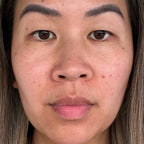 4-in-1 Radiant Renewal Skincare Wand with Red Light Therapy