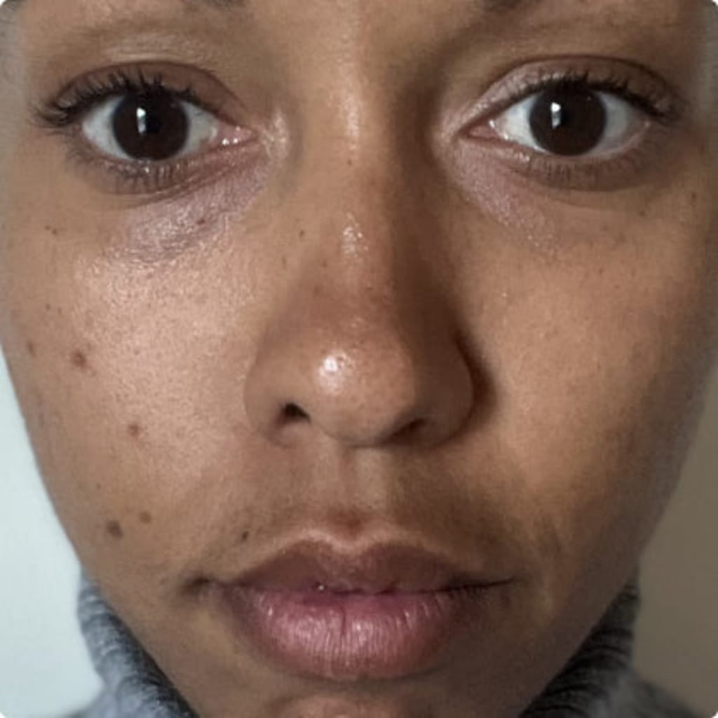 4-in-1 Radiant Renewal Skincare Wand with Red Light Therapy