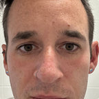 4-in-1 Radiant Renewal Skincare Wand with Red Light Therapy