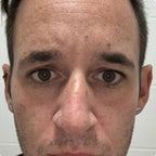 4-in-1 Radiant Renewal Skincare Wand with Red Light Therapy