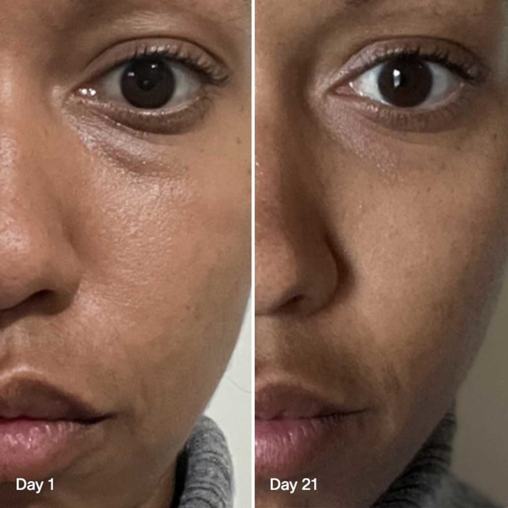 4-in-1 Radiant Renewal Skincare Wand with Red Light Therapy