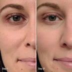 4-in-1 Radiant Renewal Skincare Wand with Red Light Therapy