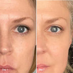 4-in-1 Radiant Renewal Skincare Wand with Red Light Therapy