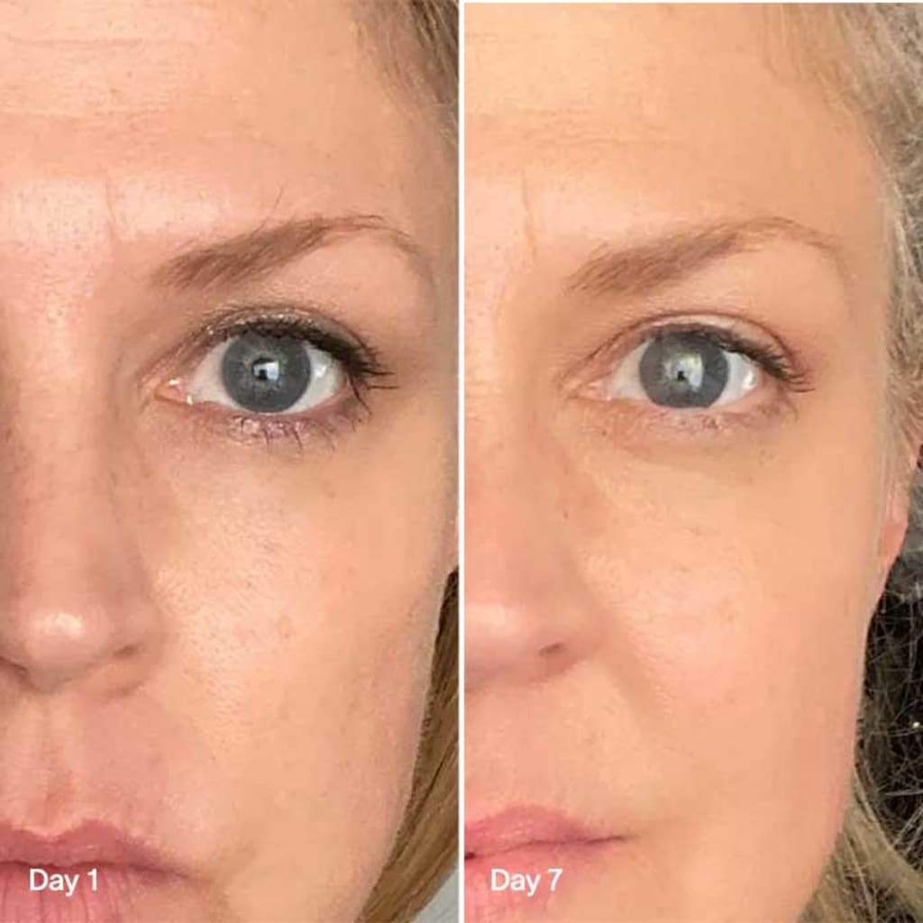 4-in-1 Radiant Renewal Skincare Wand with Red Light Therapy